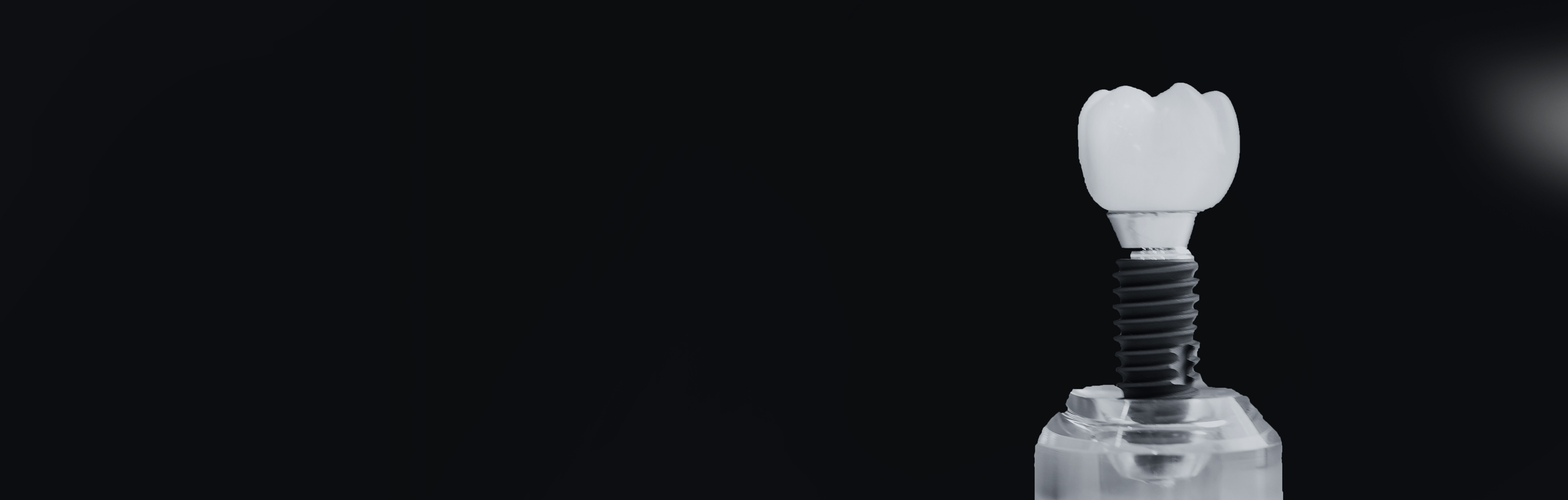 Implantologia cyfrowa Jesionowa Dental Clinic