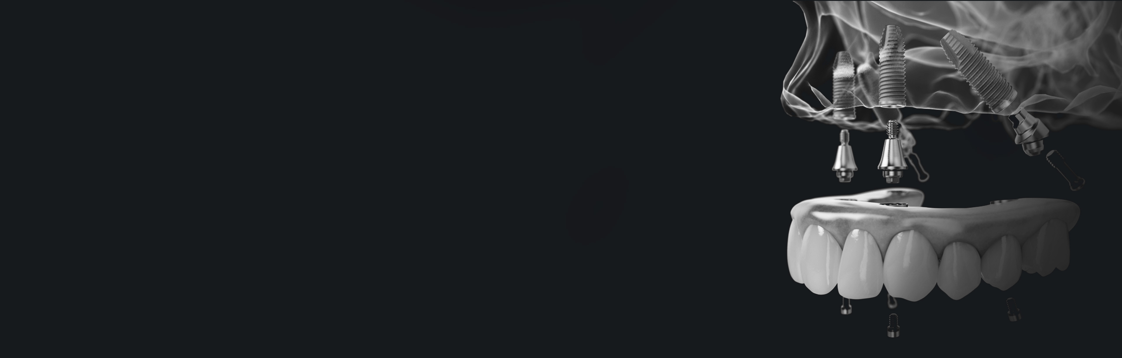 All-on-4 Jesionowa Dental Clinic